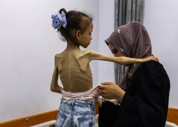 “التجويع القاتل”.. يتواصل في غزة!