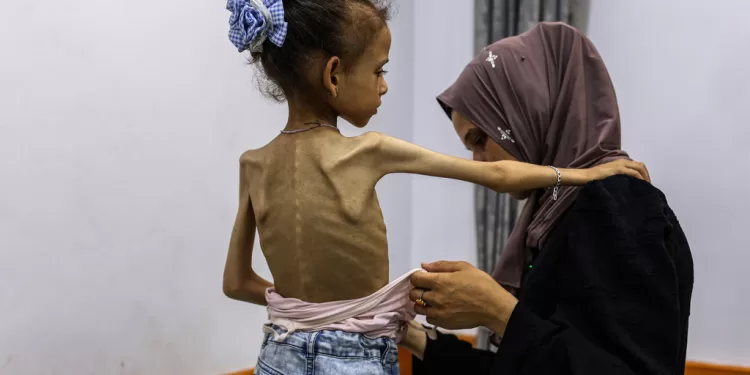 “التجويع القاتل”.. يتواصل في غزة!